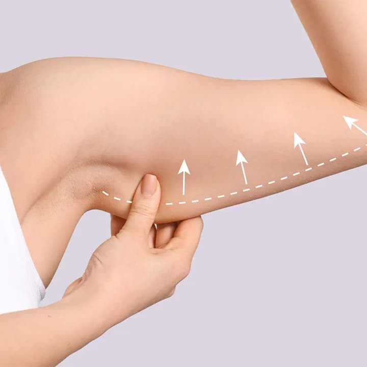 شد الذراعين والأفخاذ